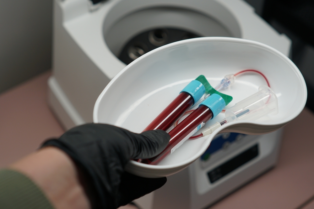 Platelet-rich plasma (PRP) preparation in centrifuge tubes during a regenerative medicine procedure for veterinary orthopedic treatment.